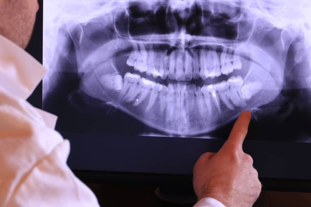 Best Weekend Emergency Dentist in Kennesaw, GA