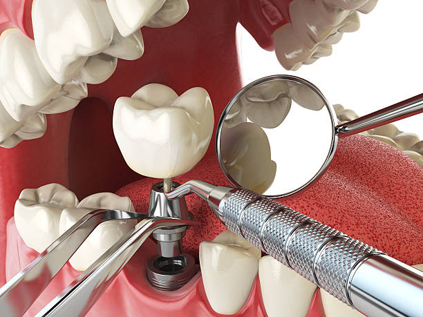Best Emergency TMJ Treatment in Kennesaw, GA